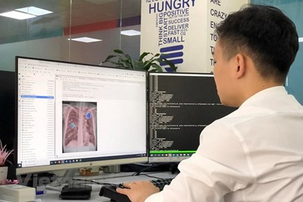 VinBrain đưa công nghệ chẩn đoán hình ảnh bằng trí tuệ nhân tạo đến Myanmar