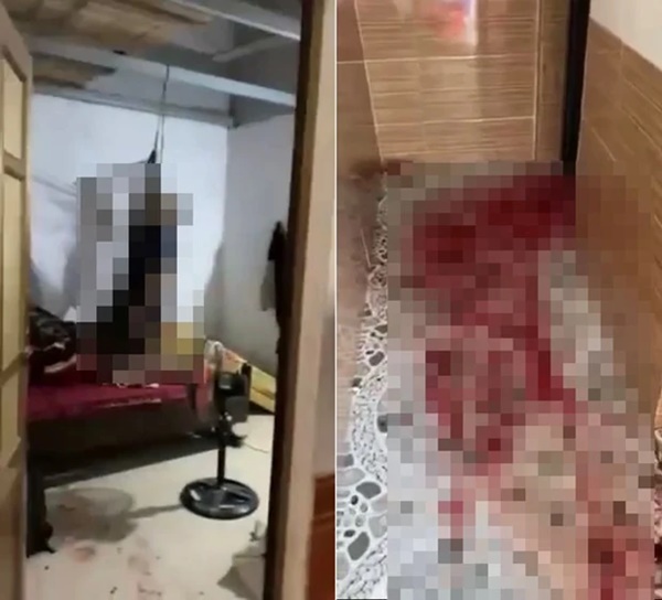 Phát hiện người đàn ông tử vong trong tư thế treo cổ, có vết thương trên đầu-1