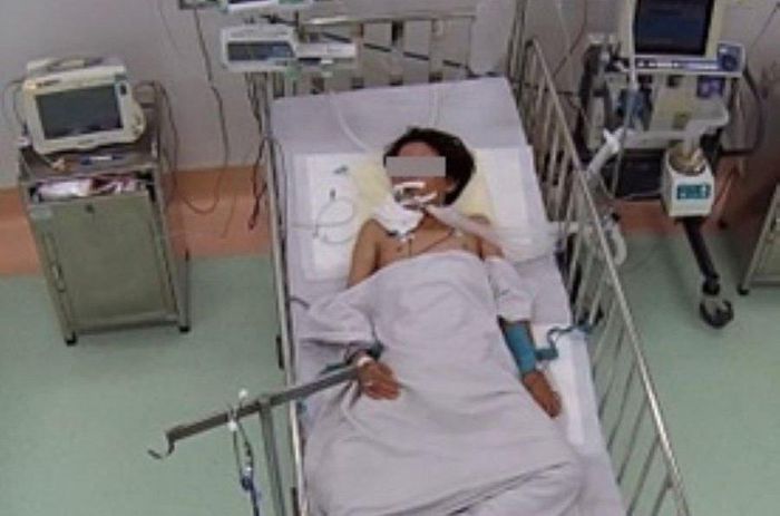 Ngủ dưới nền nhà, bé 13 tuổi bị rắn độc cắn nguy kịch-1