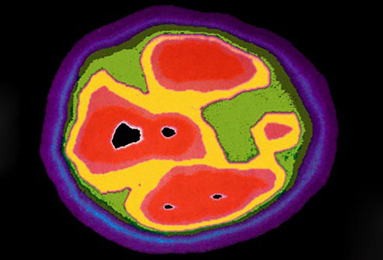 Những dấu hiệu về căn bệnh tự kỷ mà cha mẹ cần biết-6