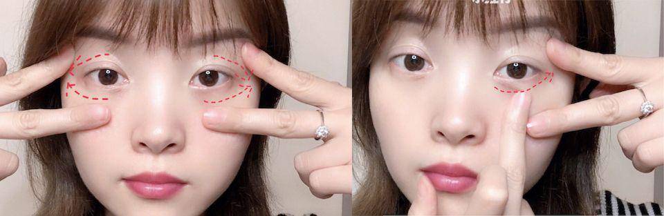 Đánh bay bọng mắt và quầng thâm sau 1 tuần với 5 cách không tốn 1 xu-5