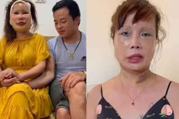 Cô dâu 62 tuổi Thu Sao lộ ngoại hình khác lạ sau khi phẫu thuật căng da mặt níu giữ tuổi xuân, tiết lộ thái độ của chồng trẻ-4