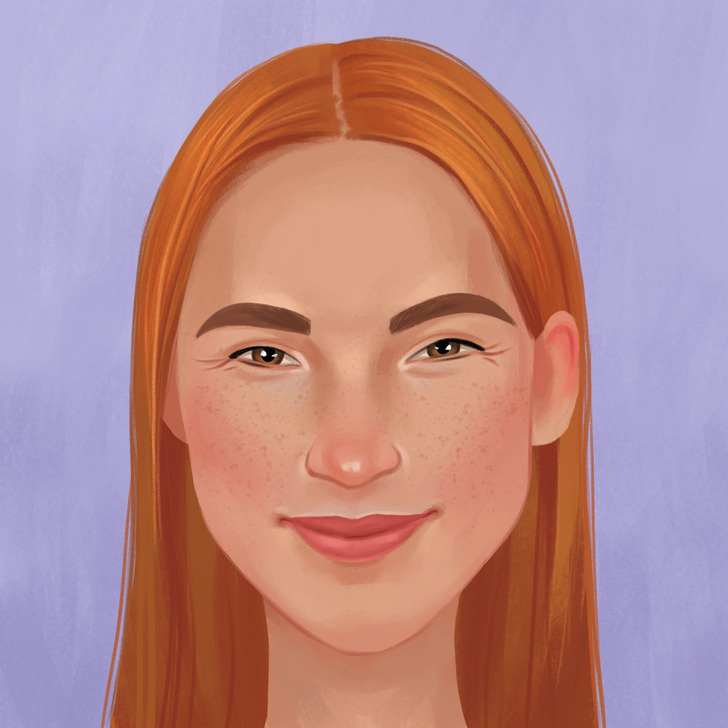 Điều gì gây ra các nếp nhăn trên khuôn mặt của bạn?-3