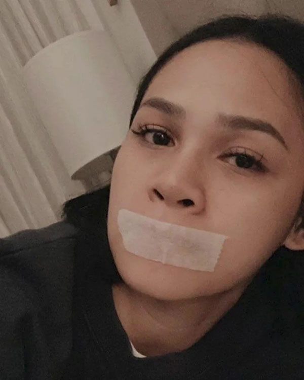 Cảnh báo trào lưu nguy hiểm trên Tiktok: Dán băng keo vào miệng mong ngủ ngon, không ngáy-2