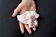 Dấu hiệu bạn đã mắc bệnh lao