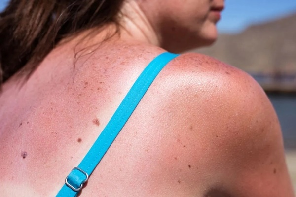 Người có tế bào ung thư trong cơ thể thường thấy 3 dấu hiệu xuất hiện vào ban đêm-6