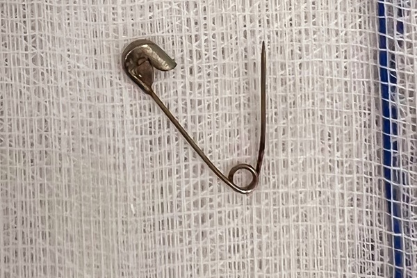 Tăm tre đâm thủng tá tràng bé 8 tuổi-2