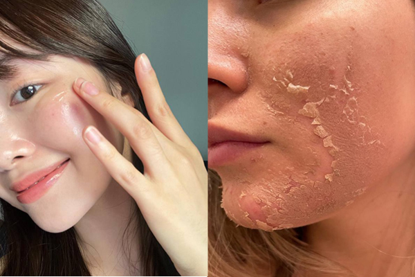 Dùng serum vitamin C bao lâu thì thấy kết quả, da trắng mịn và mờ nhăn lão hóa?-4