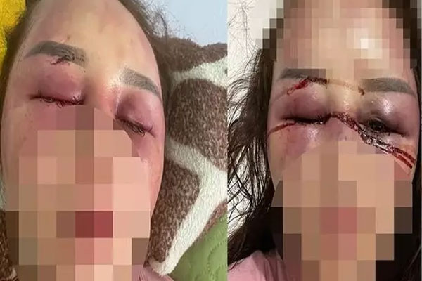 Phát hiện bé trai sơ sinh tử vong bị bỏ rơi trước cổng bệnh viện-2