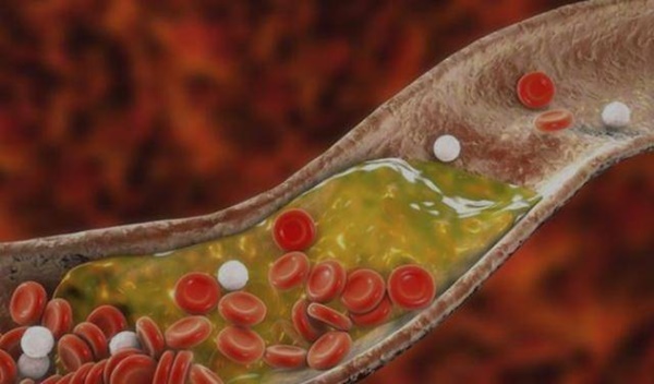 Người phụ nữ 43 tuổi ăn hành tây mỗi ngày để giảm lipid máu, điều gì đã xảy ra với cơ thể cô ấy?-1