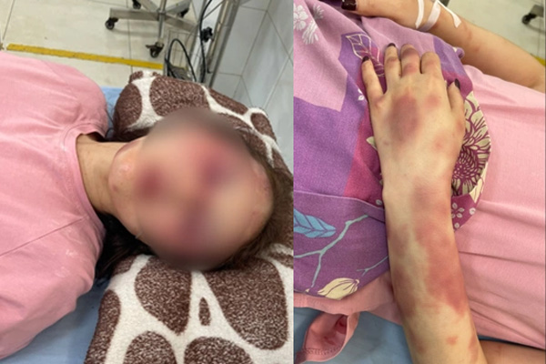 Cán bộ QLTT đánh bạn gái dã man vì hát song ca với người khác: Đã có gia đình, đánh bạn gái do quá yêu-2