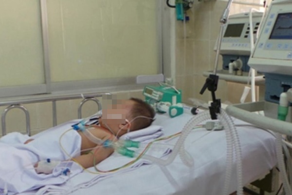 Dấu hiệu đột quỵ ở trẻ nhỏ cha mẹ nào cũng nên biết-1