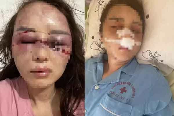 Cán bộ QLTT đánh bạn gái dã man vì hát song ca với người khác: Đã có gia đình, đánh bạn gái do quá yêu-1