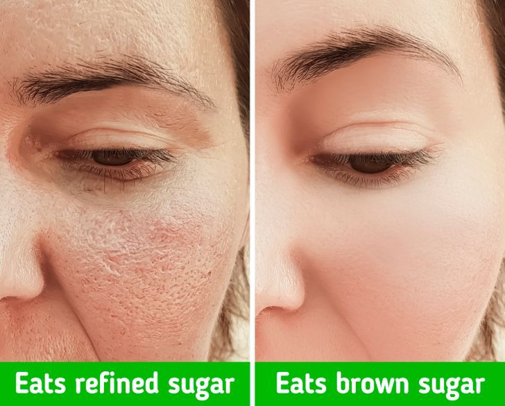 7 mẹo thu nhỏ lỗ chân lông tự nhiên được chuyên gia khuyên dùng-1