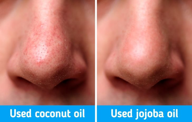 7 mẹo thu nhỏ lỗ chân lông tự nhiên được chuyên gia khuyên dùng-4