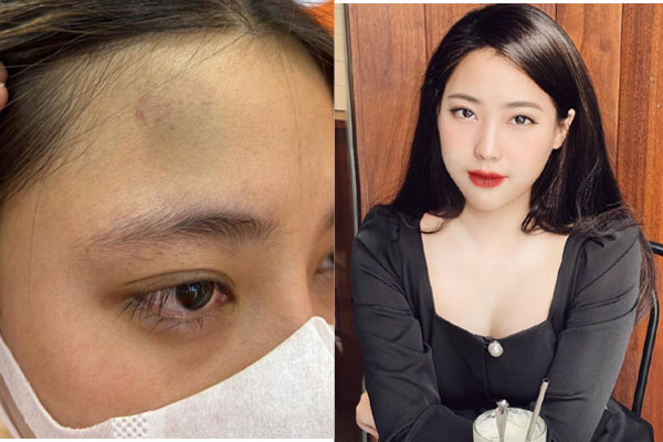 Cảnh sát huy động chó nghiệp vụ tìm kiếm Lương Hải Như-3