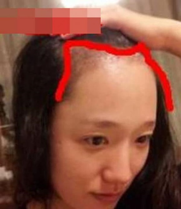 Xem tướng trán: Nhìn vài giây là biết ngay cuộc đời phú quý, sống lâu và thành công trong sự nghiệp-3