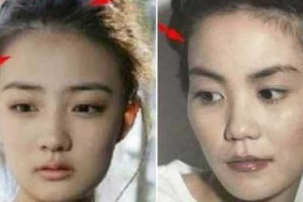 Nốt ruồi ở dái tai nói gì về tương lai của bạn? Vượng tài lộc hay nghèo mạt kiếp?-3