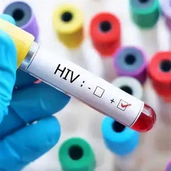 Thanh niên suy sụp vì xét nghiệm dương tính với HIV, 5 năm sau phát hiện sự thật gây sốc-1