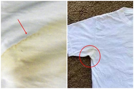 Quần áo trắng bị ngả vàng toàn chỗ 