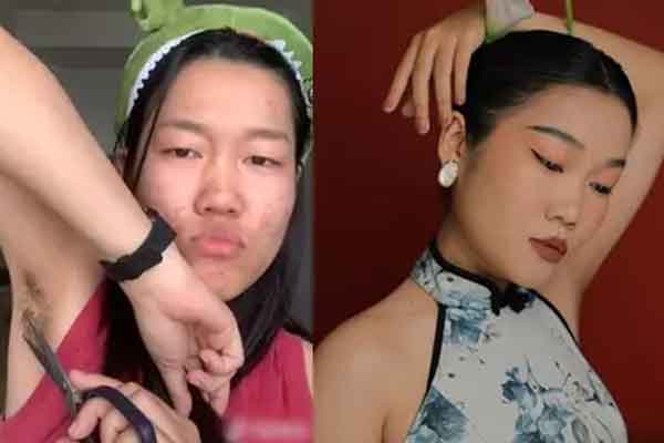 Phát hiện ung thư khi mới ngoài 20, TikToker triệu view dùng đam mê chiến đấu với bệnh tật-10