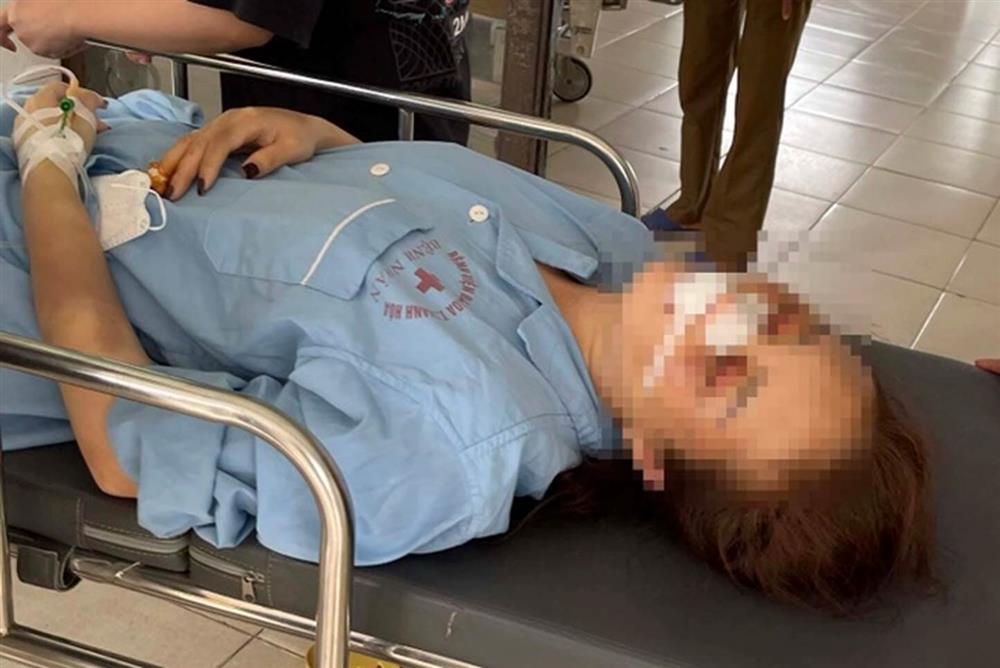 Vụ đánh người tình vì song ca với người khác: Công an đưa nạn nhân đi giám định thương tật-1