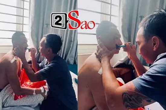 Nam MC đình đám bị tai nạn, lệch hàm, gãy đôi xương vai