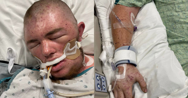 Mỹ: Nguy kịch vì bị ong đốt hàng chục ngàn vết-1