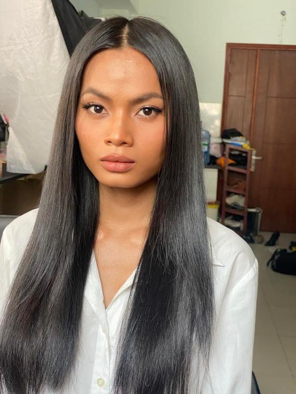 Người mẫu Châu Kim Sang đang nguy kịch, duy trì sự sống bằng máy thở-4