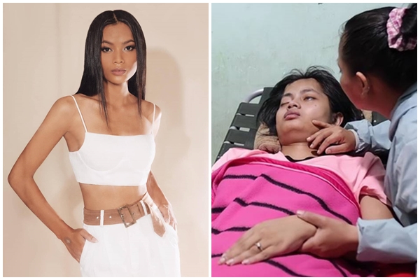 Người mẫu Châu Kim Sang nguy kịch, dự báo khó qua khỏi-7