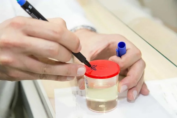 Đi tiểu gặp 3 dấu hiệu này cần kiểm tra lượng đường huyết có tăng không-5