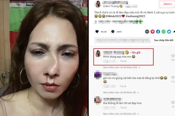 Sự thật cô gái làm đẹp bị chồng đánh méo mũi xôn xao cõi mạng-1