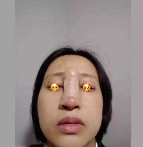 Sự thật cô gái làm đẹp bị chồng đánh méo mũi xôn xao cõi mạng-5