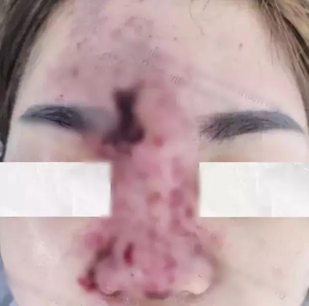 Sự thật cô gái làm đẹp bị chồng đánh méo mũi xôn xao cõi mạng-7