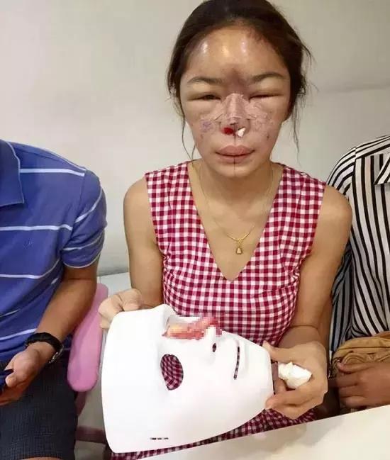 Sự thật cô gái làm đẹp bị chồng đánh méo mũi xôn xao cõi mạng-8