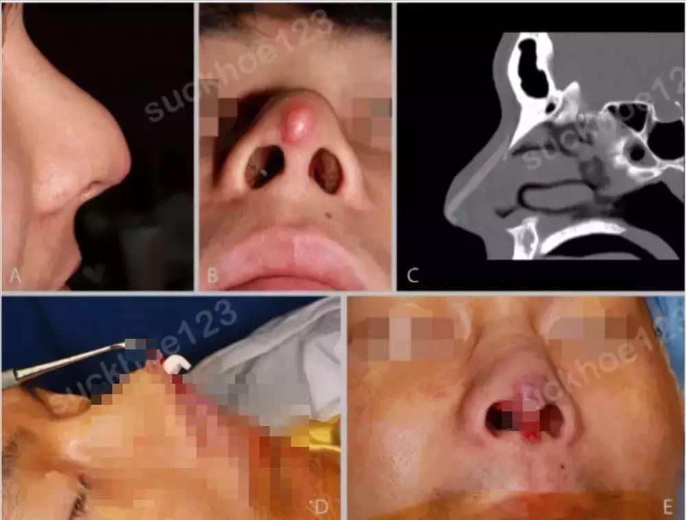 Sự thật cô gái làm đẹp bị chồng đánh méo mũi xôn xao cõi mạng-9