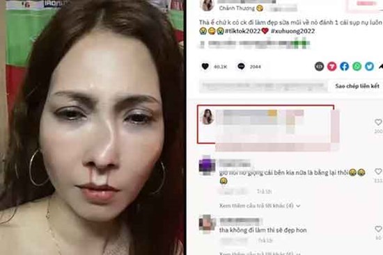 Sự thật cô gái làm đẹp bị chồng đánh méo mũi xôn xao cõi mạng