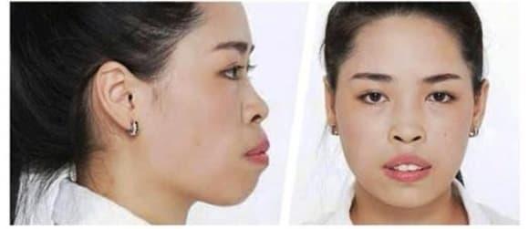 Hot girl dao kéo Vũ Thanh Quỳnh: Nhan sắc và cuộc sống thay đổi thế nào sau gần 8 năm?-2