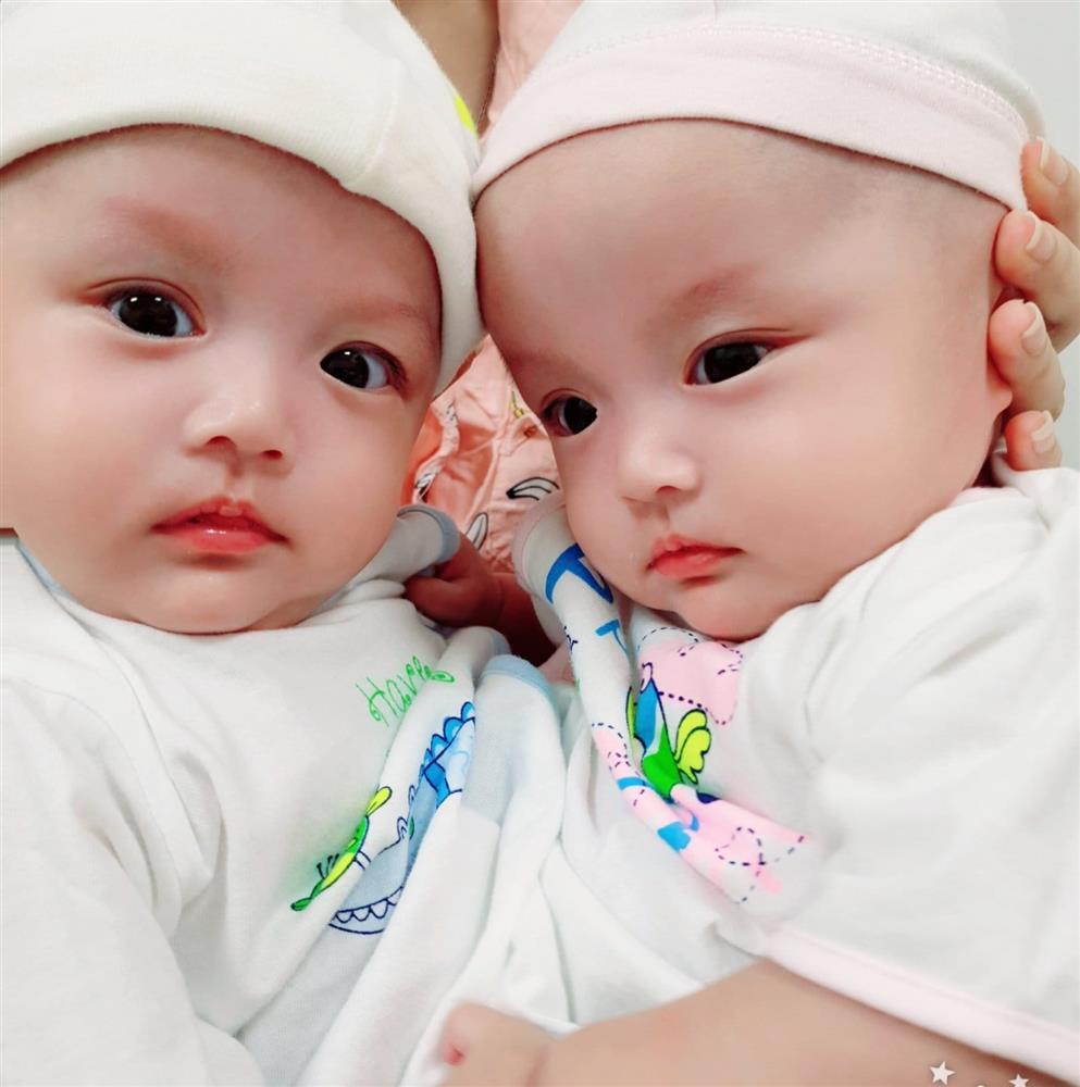 Ảnh mới nhất về cặp song Nhi sau 2 năm phẫu thuật tách dính-1