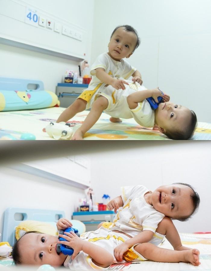 Ảnh mới nhất về cặp song Nhi sau 2 năm phẫu thuật tách dính-3