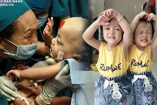 Ảnh mới nhất về cặp song Nhi sau 2 năm phẫu thuật tách dính