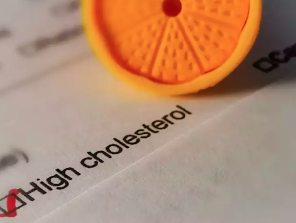 Đau ở 3 vùng này có thể là dấu hiệu của cholesterol cao-2