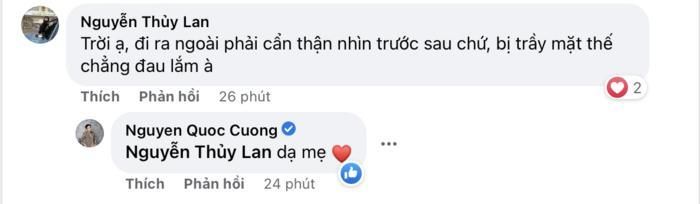 Cường Đô La trầy trụa gương mặt vì tai nạn giao thông, Đàm Thu Trang xót chồng nên ra lệnh cấm-3