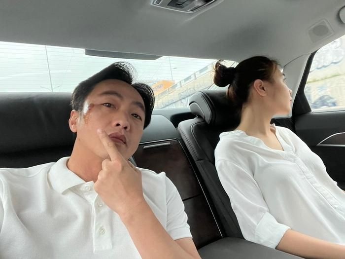 Cường Đô La trầy trụa gương mặt vì tai nạn giao thông, Đàm Thu Trang xót chồng nên ra lệnh cấm-1