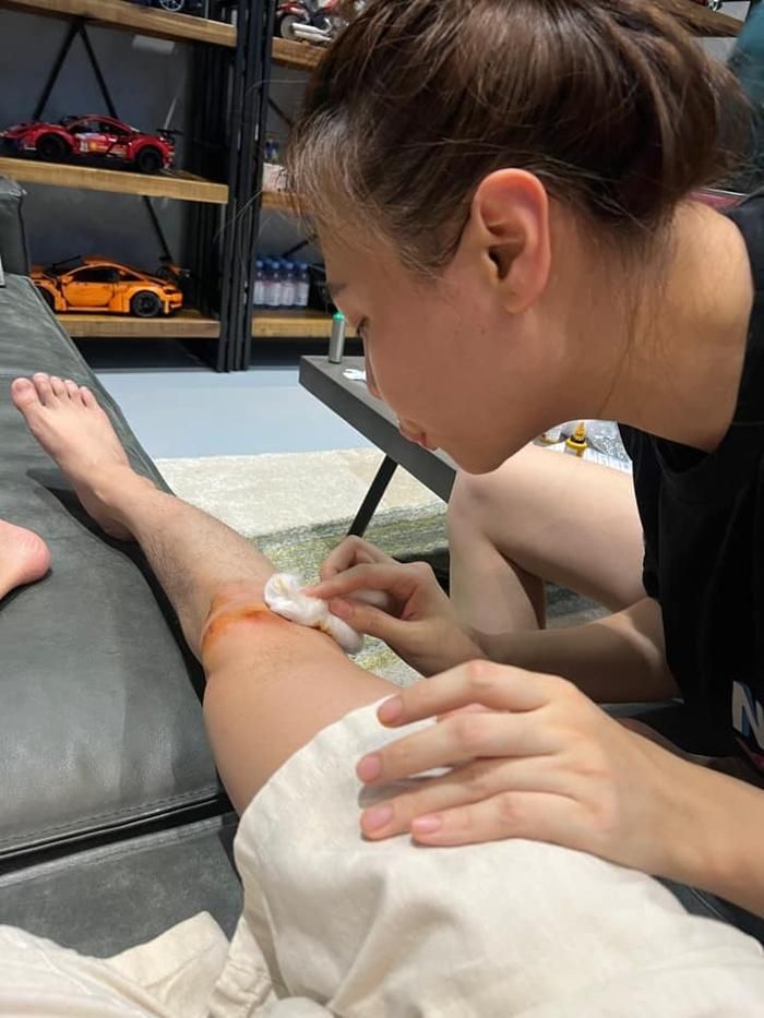 Cường Đô La trầy trụa gương mặt vì tai nạn giao thông, Đàm Thu Trang xót chồng nên ra lệnh cấm-2