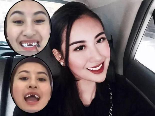 Trang Nemo xuất hiện với bộ nhá bất ổn, cái còn cái mất-8