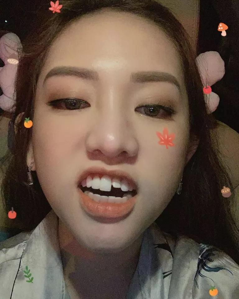 Trang Nemo xuất hiện với bộ nhá bất ổn, cái còn cái mất-9