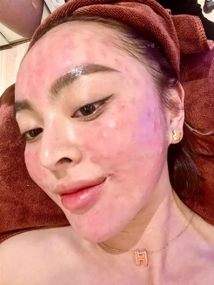 Trang Nemo nói chuyện rớt cả răng, anh xã phản ứng phũ-5