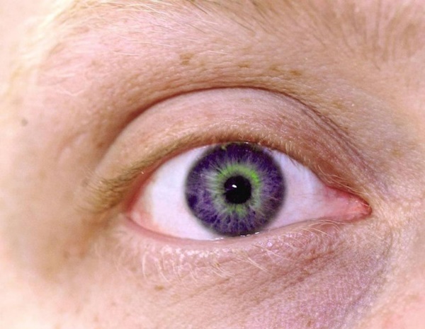 Hai bộ phận trên cơ thể bị ngứa rất có thể là dấu hiệu của bệnh xơ gan, thủ phạm là 3 thứ này trong bếp-2