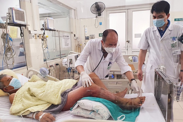 Hoại tử chân tím đen, suy gan thận do loại vi khuẩn có ở nước biển-1